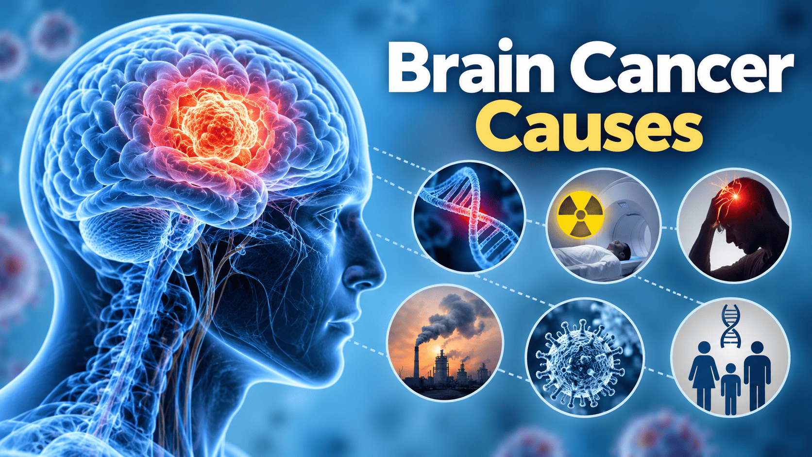 Brain Cancer Causes